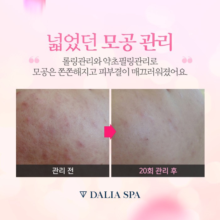 약손피부관리실 이미지