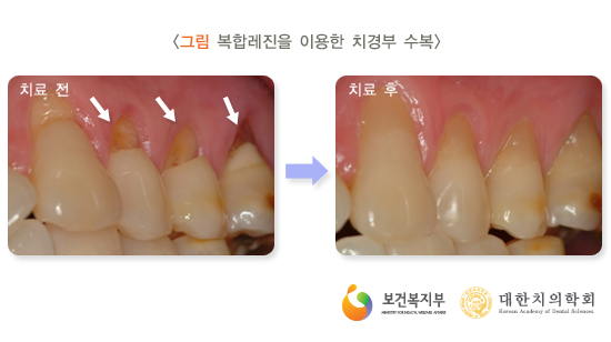 하얀치과 이미지
