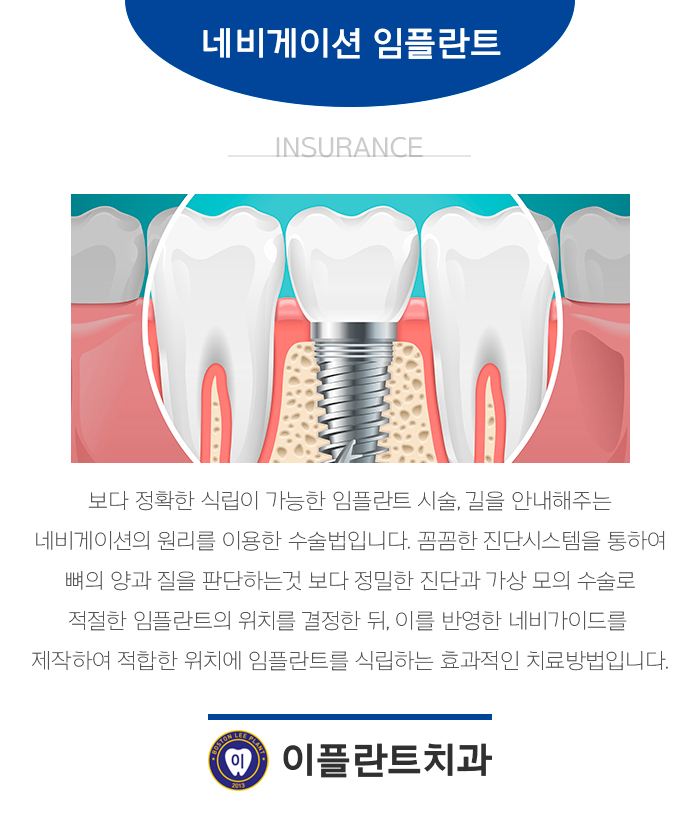 이플란트치과 이미지