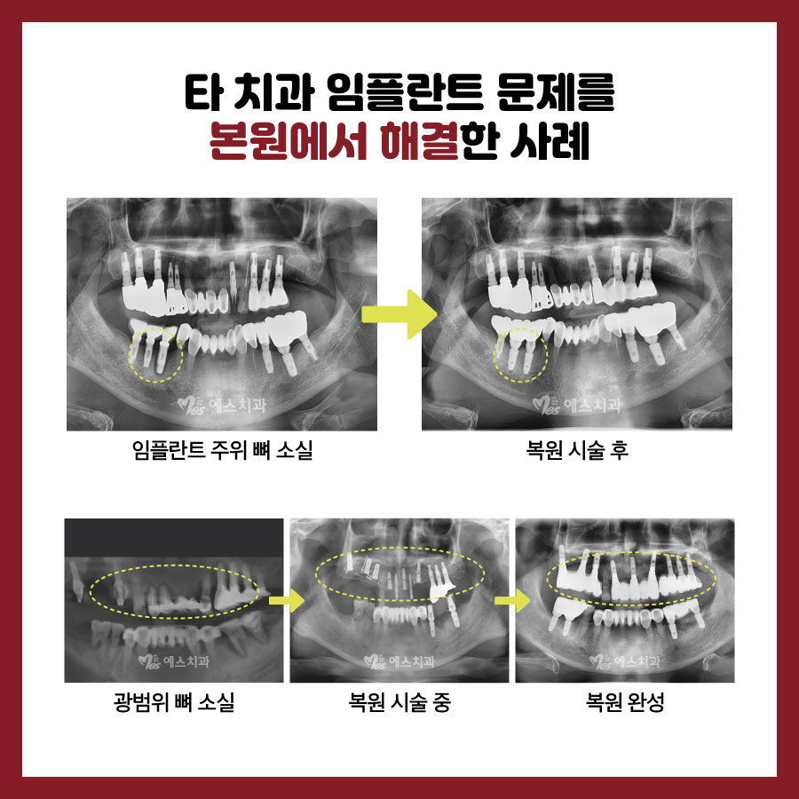 예스플러스치과 이미지