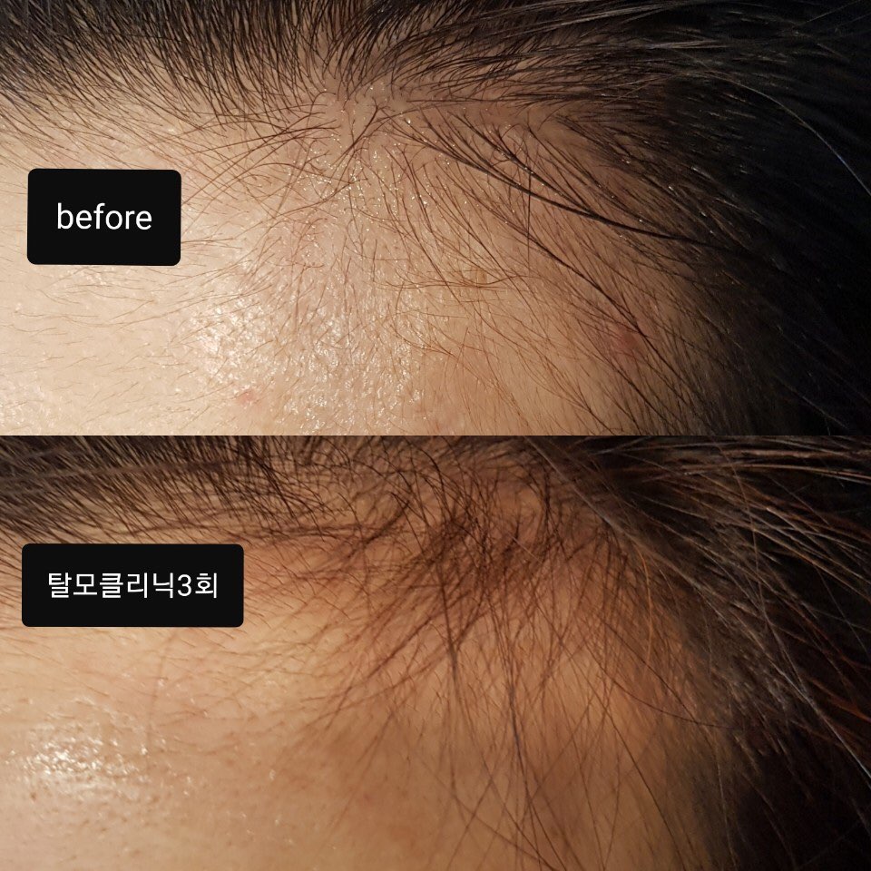 뷰티호텔 이미지