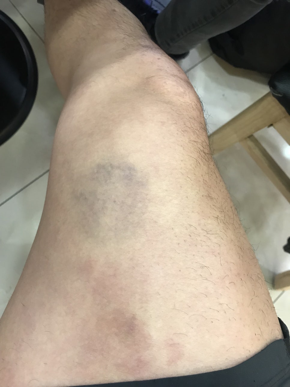 제이준핏 이미지