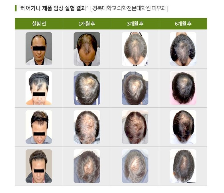 헤어가나 이미지