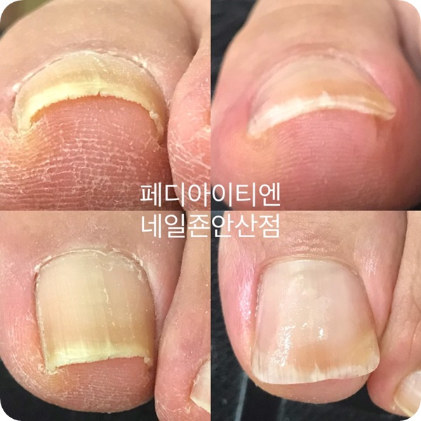 네일죤 이미지
