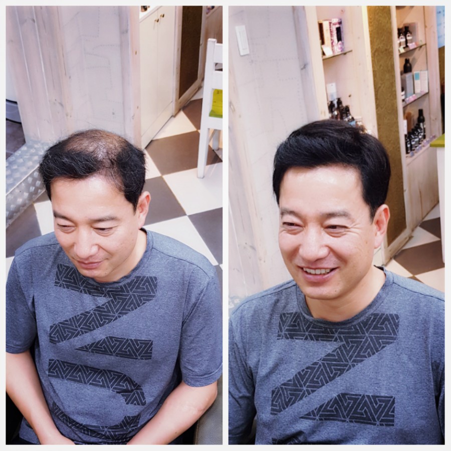 김호증모가발춘천체인점 이미지