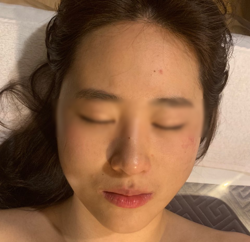 리엔스킨케어 이미지
