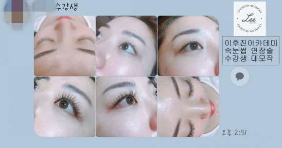 이후진 이미지