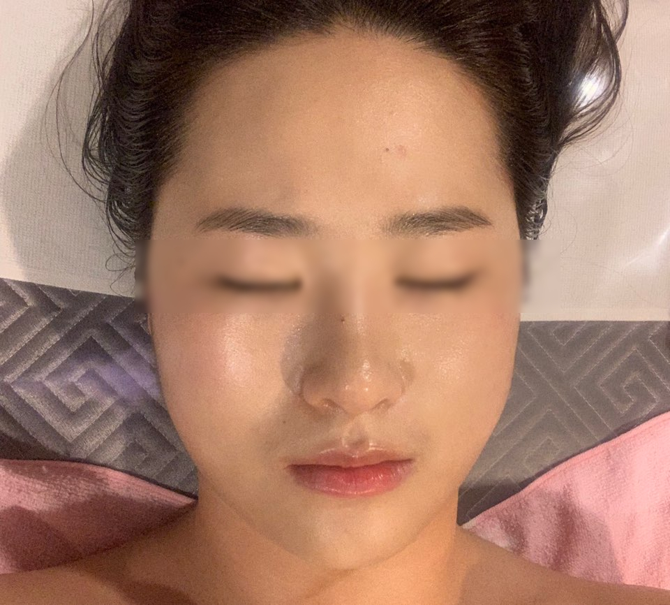 리엔스킨케어 이미지