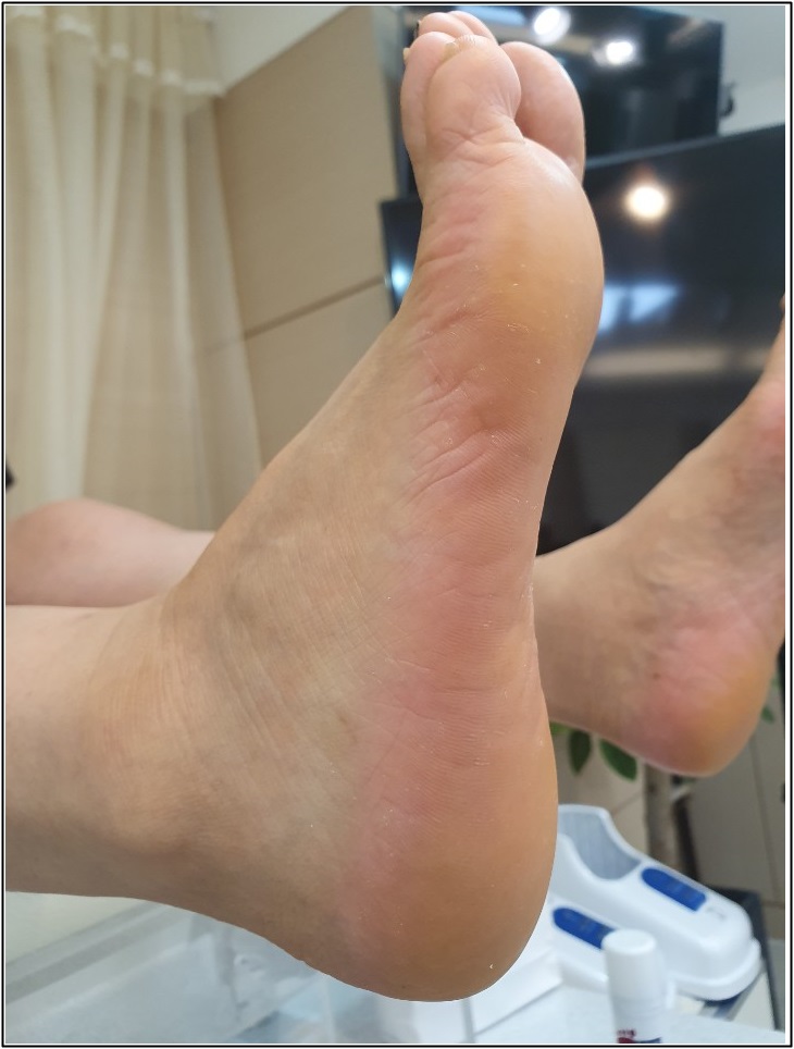 네일라인 이미지