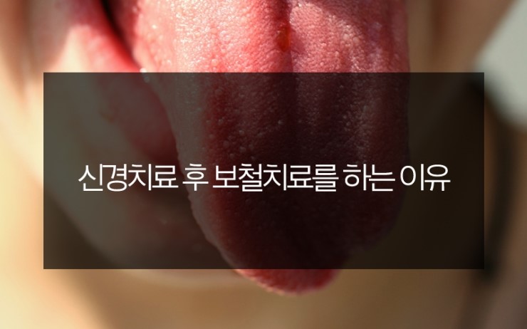 100세치과 이미지