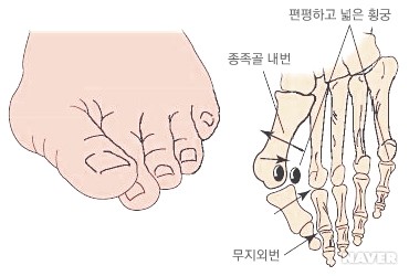 아이디얼바디 이미지