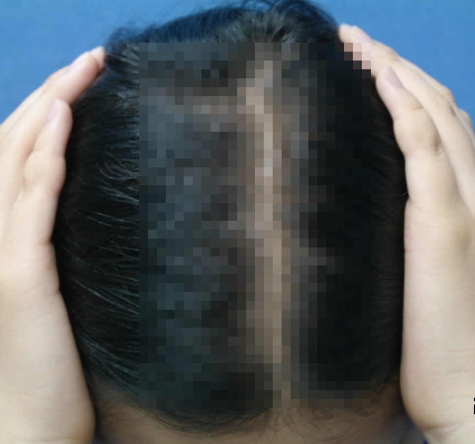 더리턴피부과 이미지
