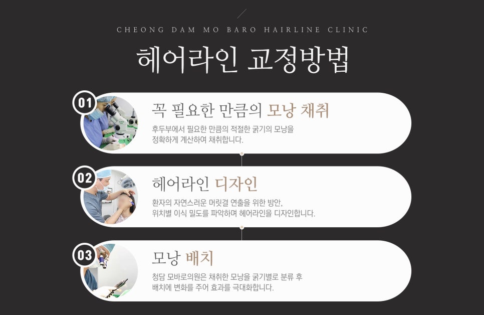 정 헤어라인 이미지