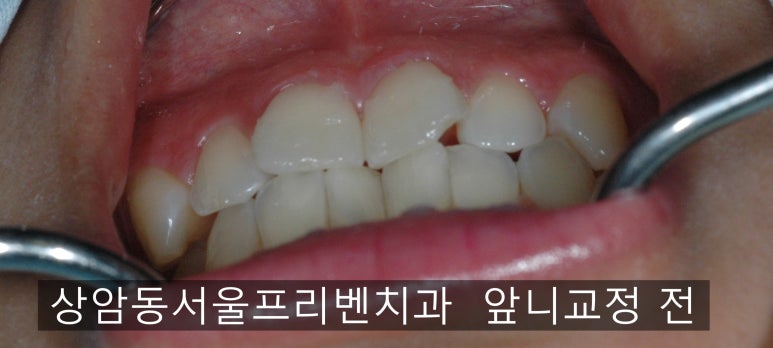 서울프리벤치과의원 이미지