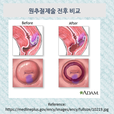 경부전기 이미지