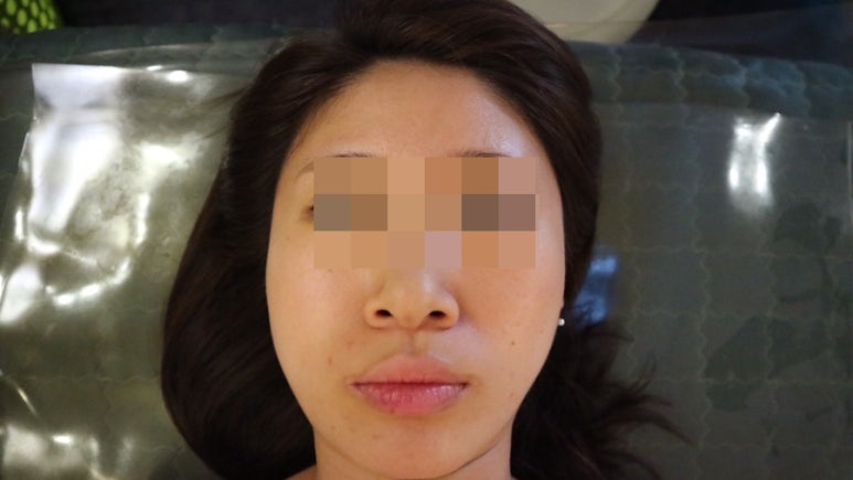 벨라지다 이미지