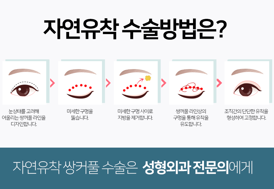 아티스성형외과 이미지