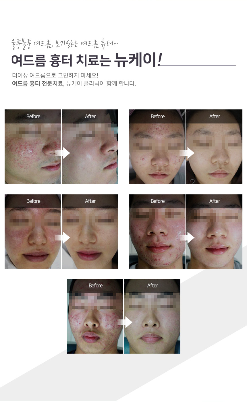 뉴케이의원 이미지