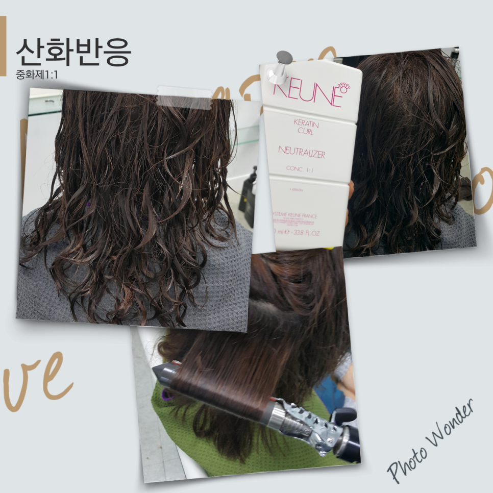 스펠라 헤어 메디컬 이미지