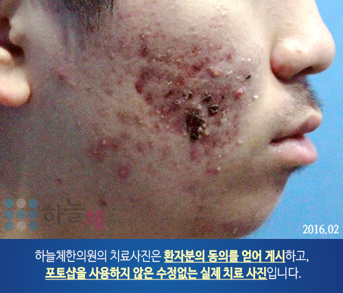 하늘체한의원 이미지