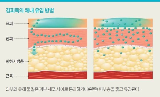 초이테라피 이미지