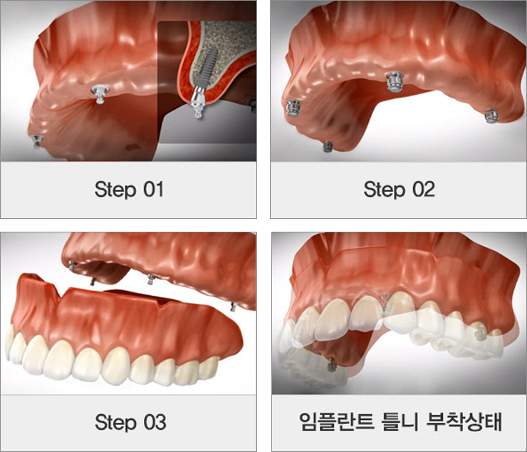 서울모아치과 이미지