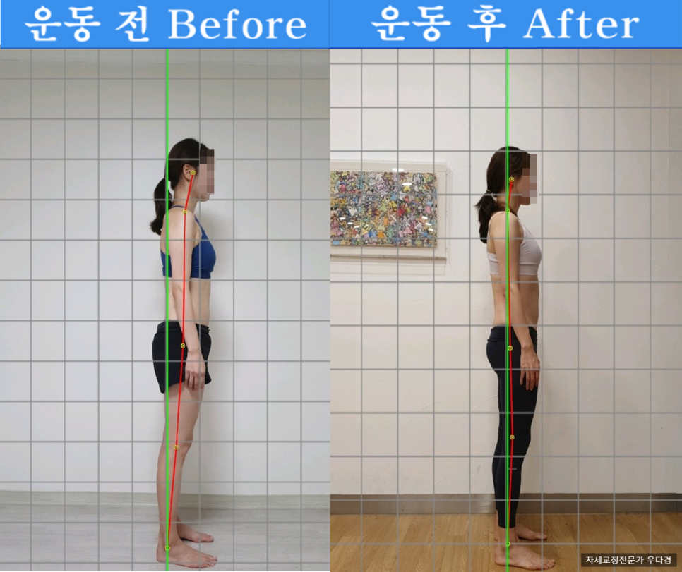 바른자세교정센터 이미지