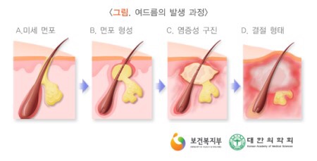 라파에스테틱 이미지