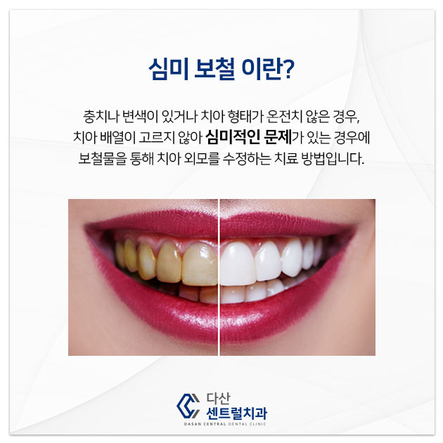 바른우리치과 이미지