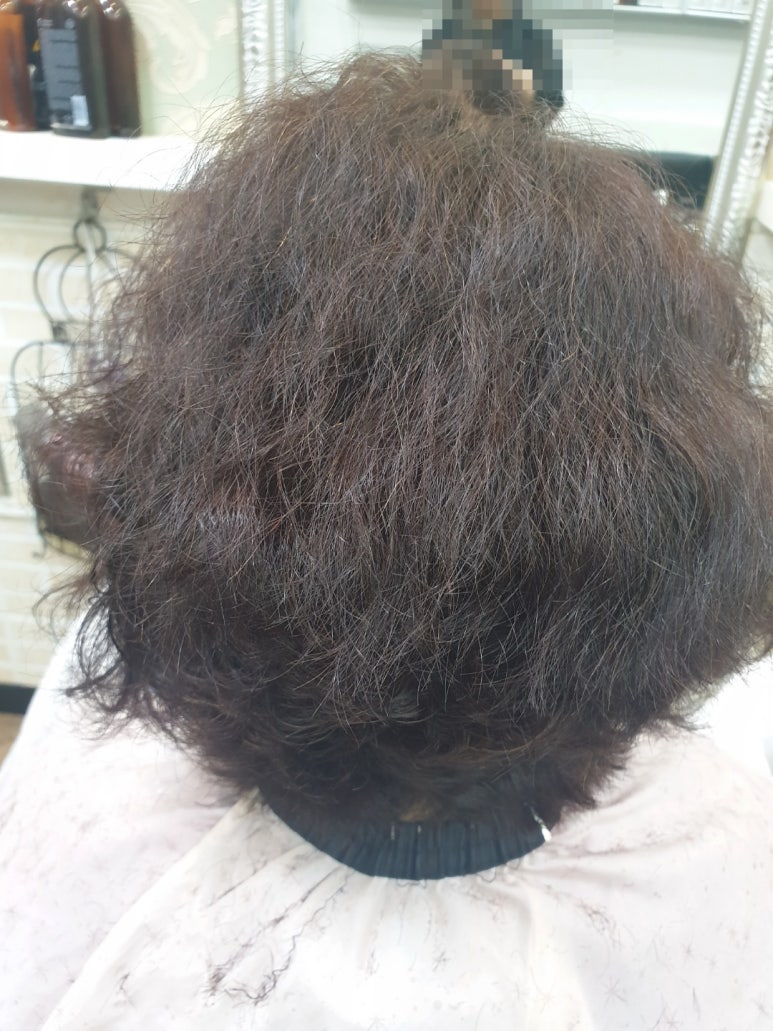 필헤어라인 이미지