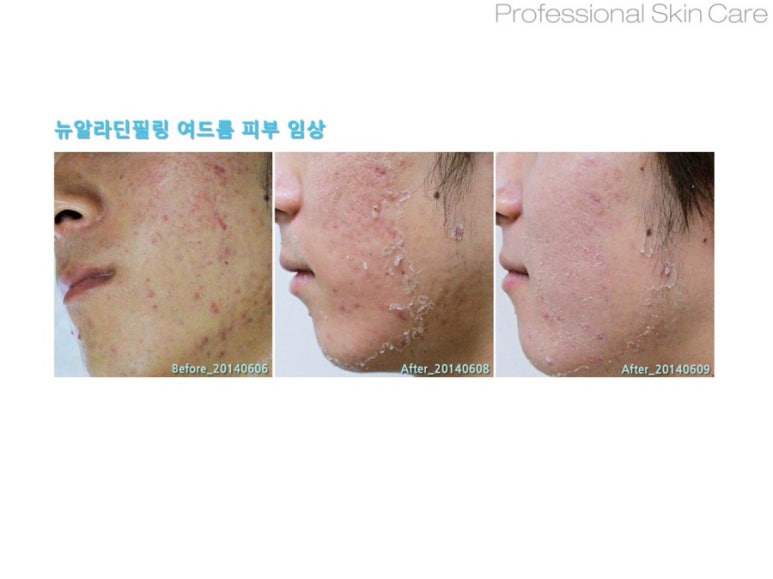 로즈메디 이미지