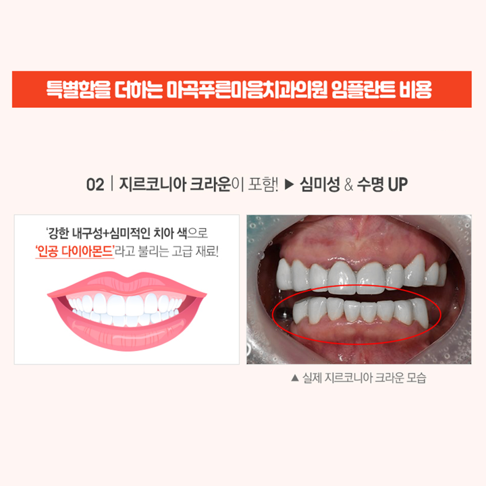 푸른치과의원 이미지