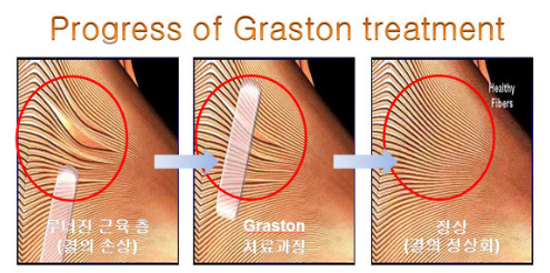 새부산스포츠 이미지