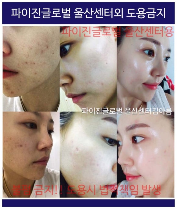 볼륨톡스 이미지