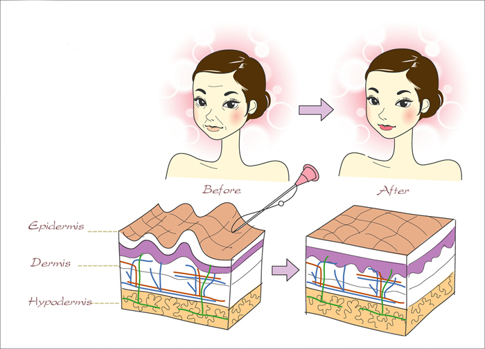 엘라스틴미아사거리역 이미지