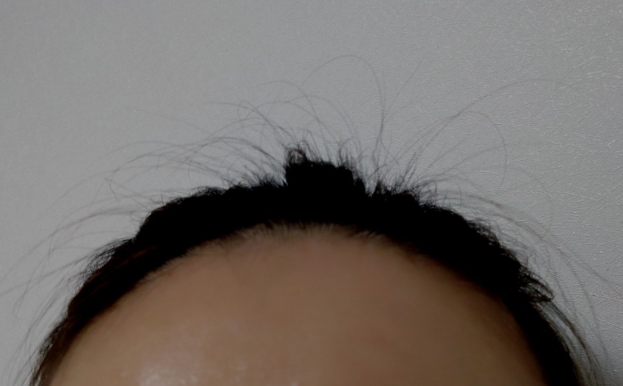 지니스칼프 이미지