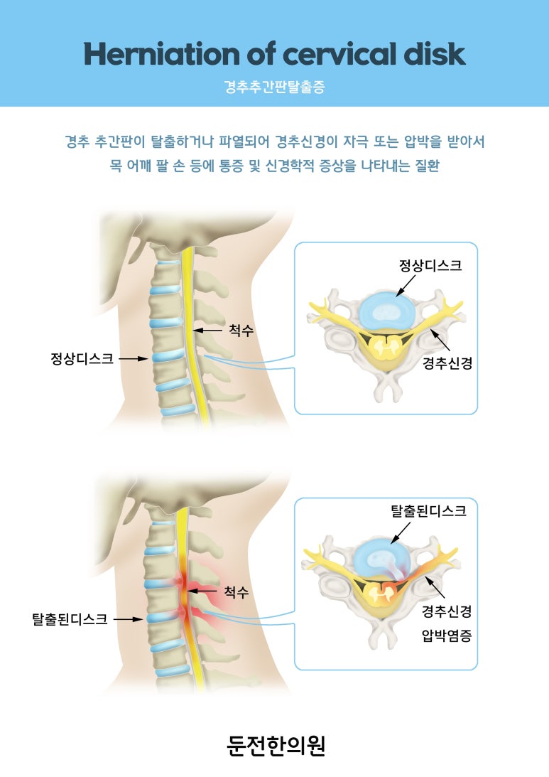 둔전한의원 이미지