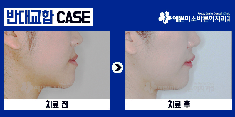 바른이치과의원 이미지