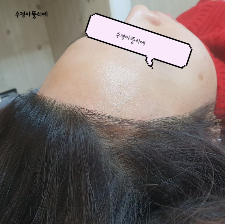 수경헤어라인 이미지