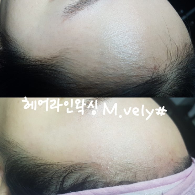 엠블리헤어 이미지