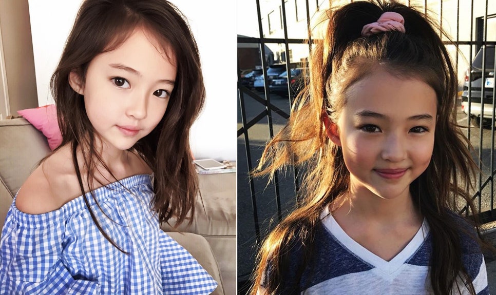 아이그로스 이미지