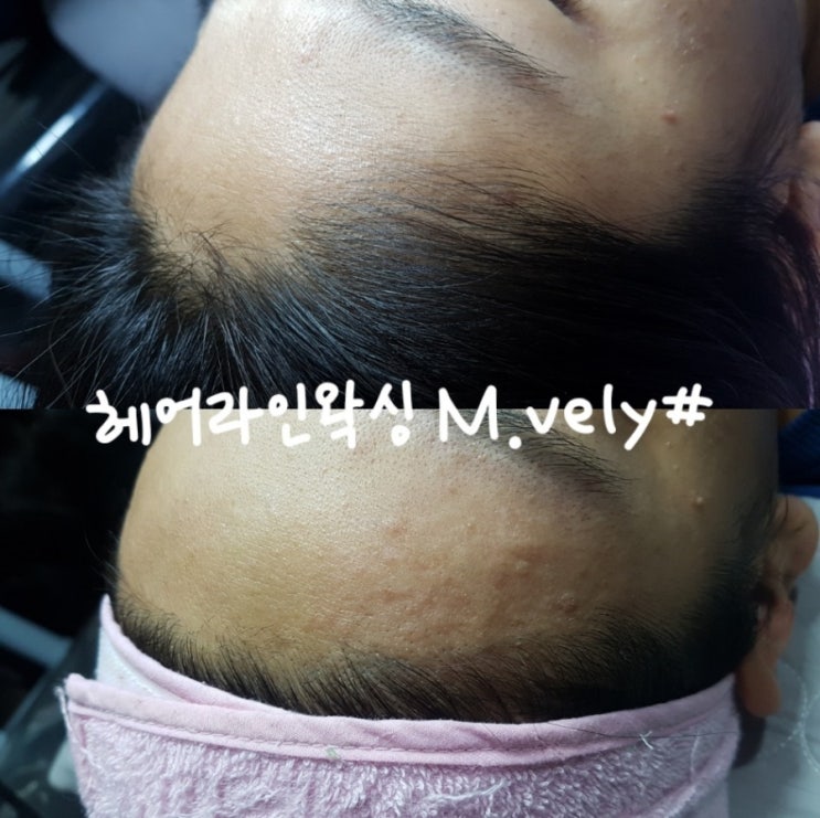 엠블리헤어 이미지
