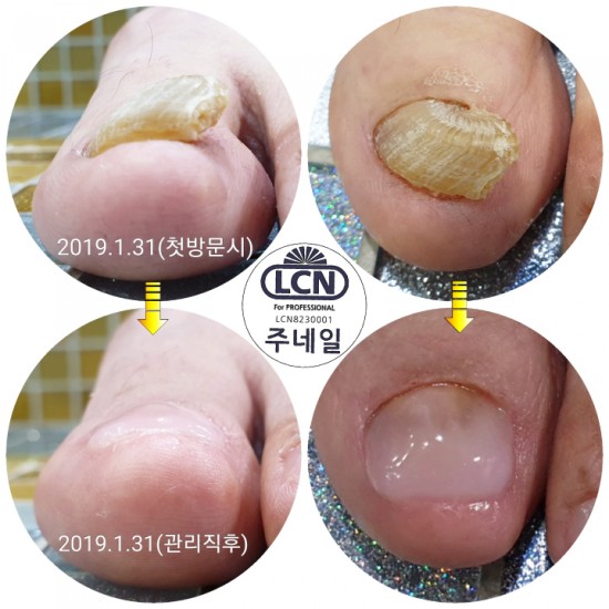주네일(JuNail) 이미지