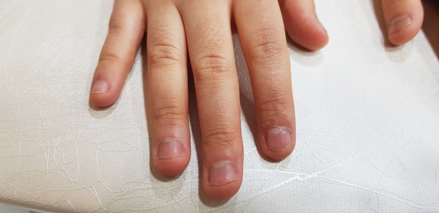바비네일 이미지