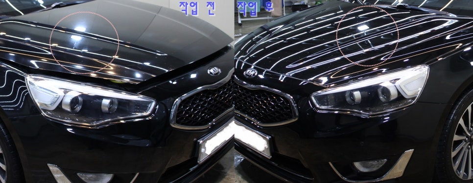 에이치카케어 이미지