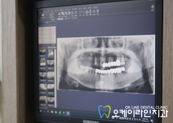 오케이라인치과 이미지