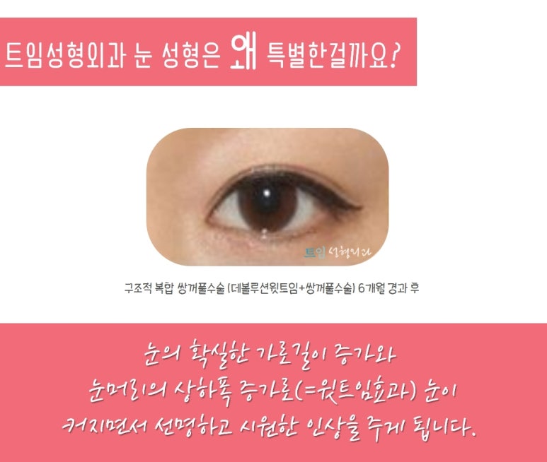 인아웃 이미지