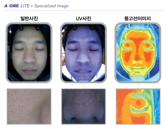 정피부 이미지