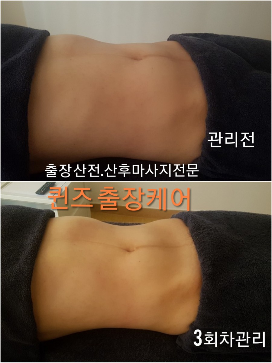 퀸즈산모케어 이미지
