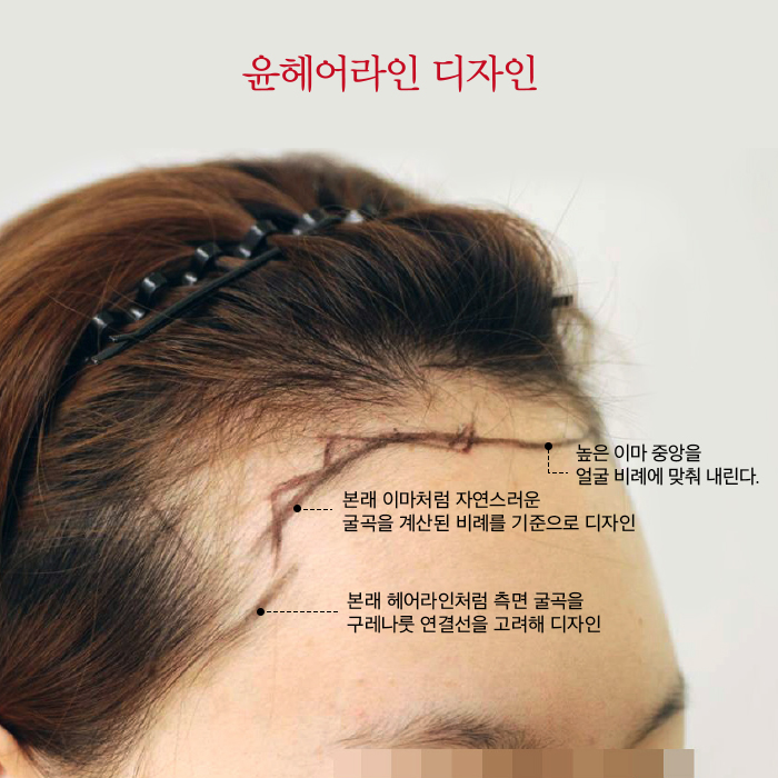 헤어온의원 이미지